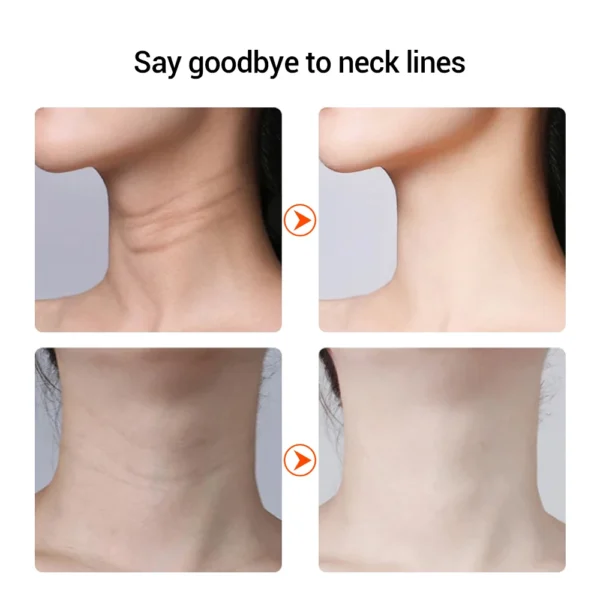 EMS Microcurrent Face Neck Beauty Device LED Photon Firming Rejuvenating Anti Wrinkle Thin Double Chin Skin Care Facial Massage - Image 5